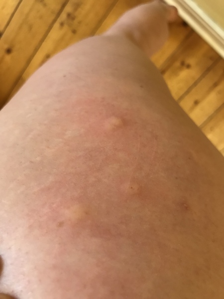 Do we have bedbugs? I am desperate for advice!