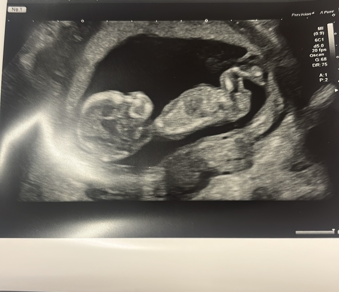 Gender guess??