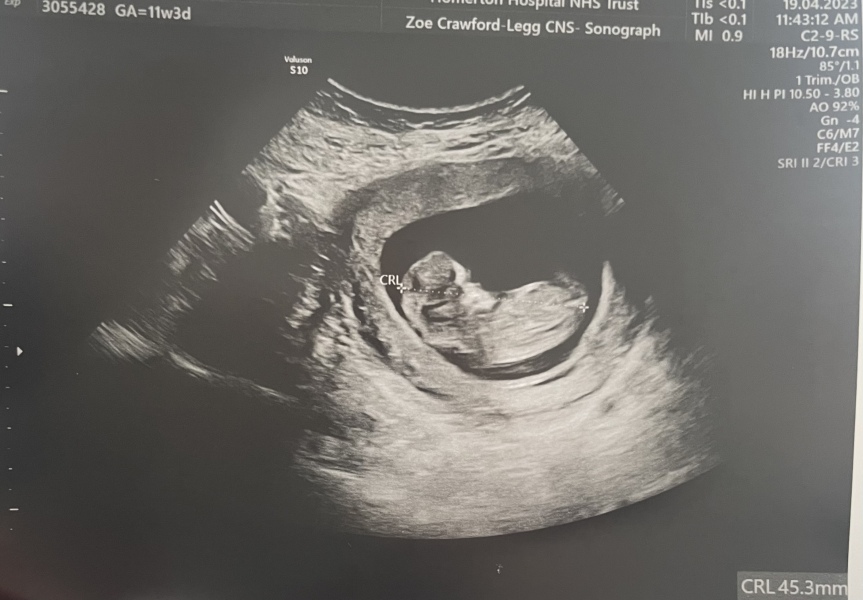 Due November 2023 Part 3