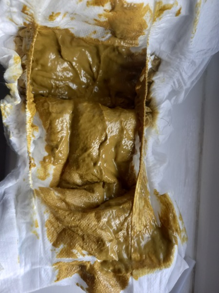 CMPA and my Baby's poo