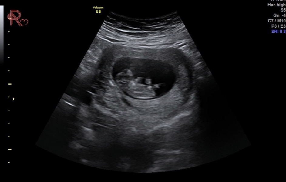 Due November 2023 Part 3