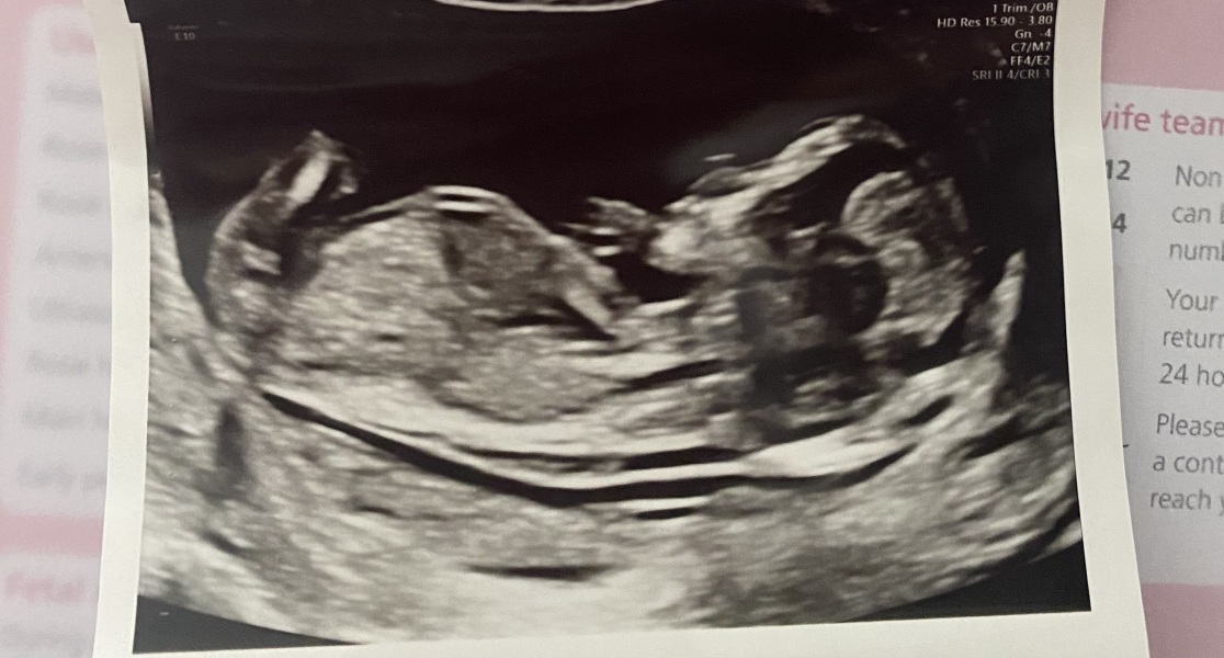 Gender guesses