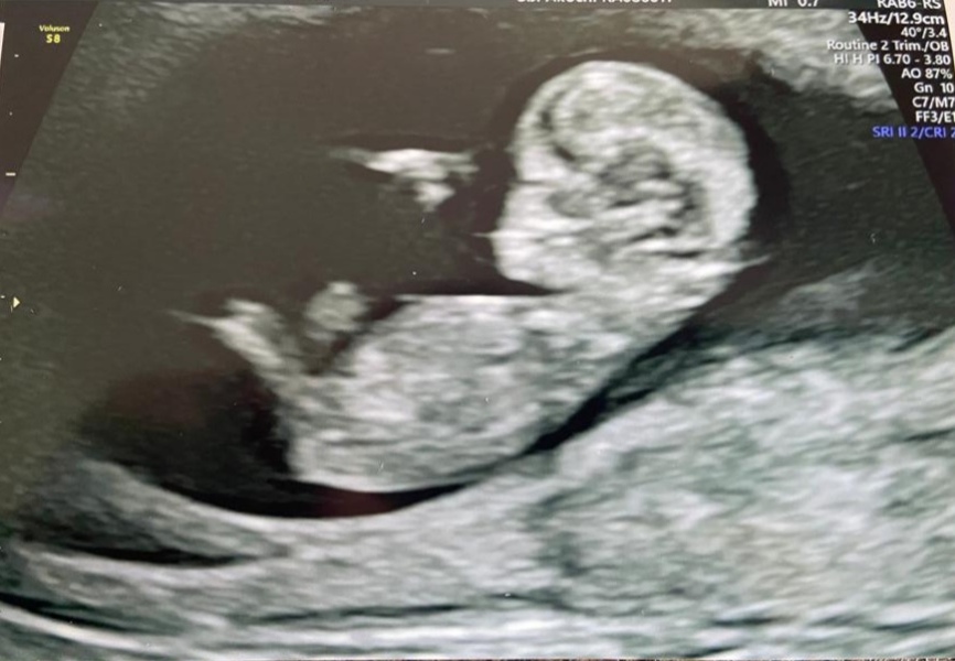 Due October 2023 - thread 4