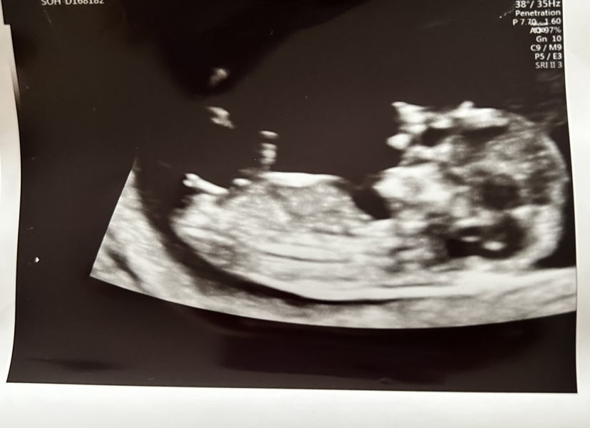 October - into the second trimester!