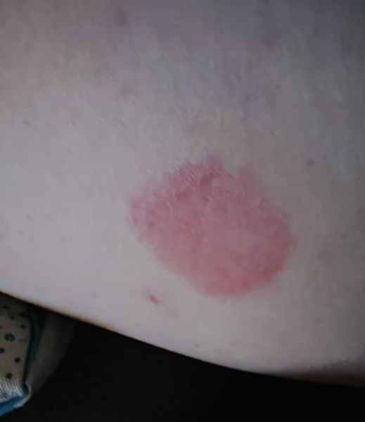 What is this thing on my leg?