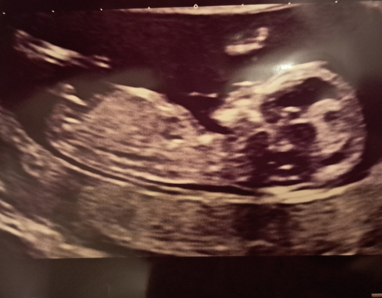 Due October 2023 - thread 6