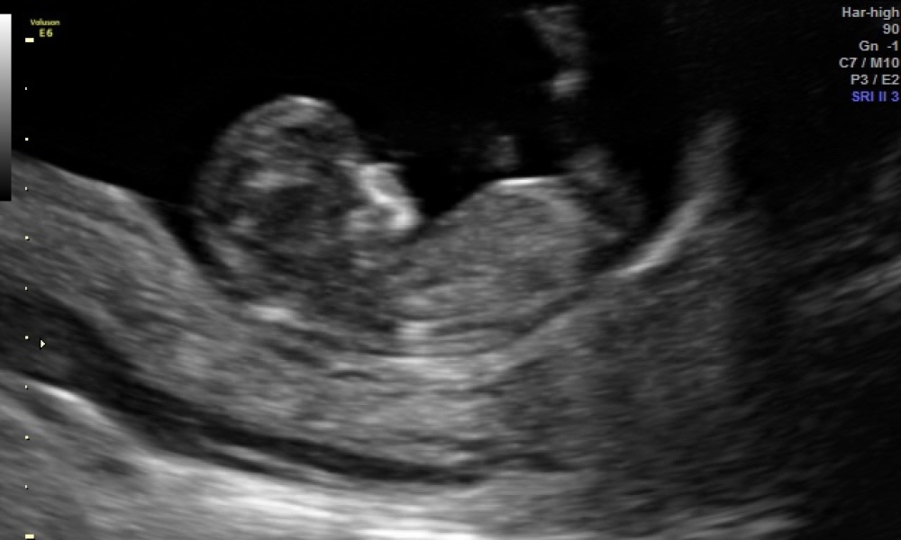 October - into the second trimester!