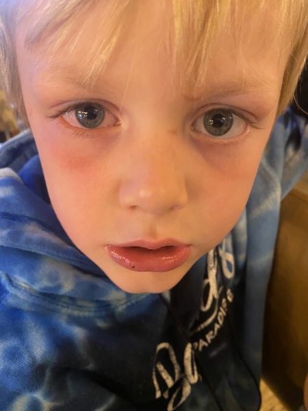 Green of blue eyes?
