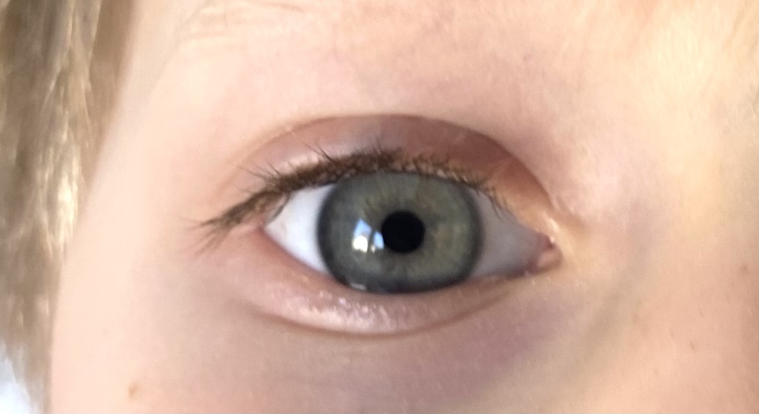 What colour are these eyes? 