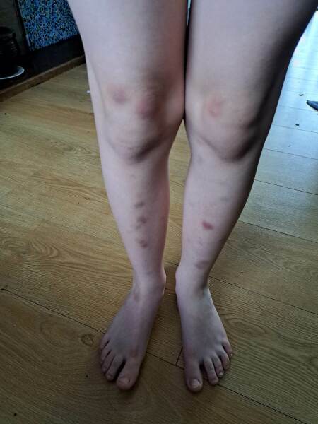 Autistic women assemble!