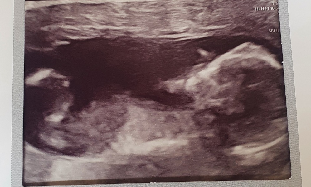 October - into the second trimester!