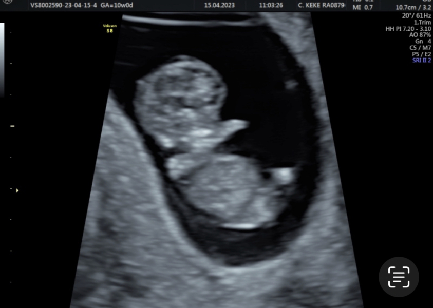 TWW - Testing Around 1st March 