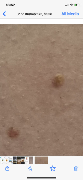 Any mole experts?