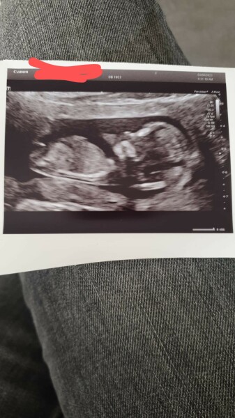 Boy or girl?  Nub theory? 