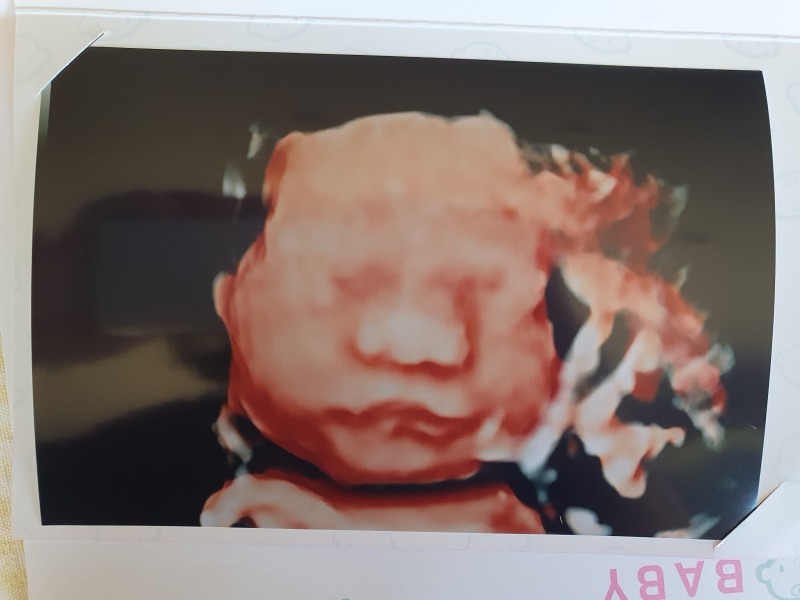 June 2023 Babies ☀️ (Thread Five)