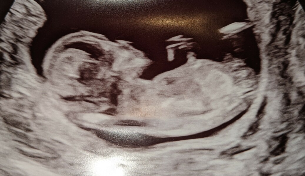 Due November 2023 Part 3