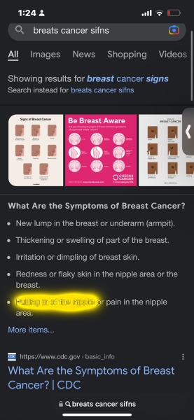 Nipple photo attached - am I worrying for nothing?