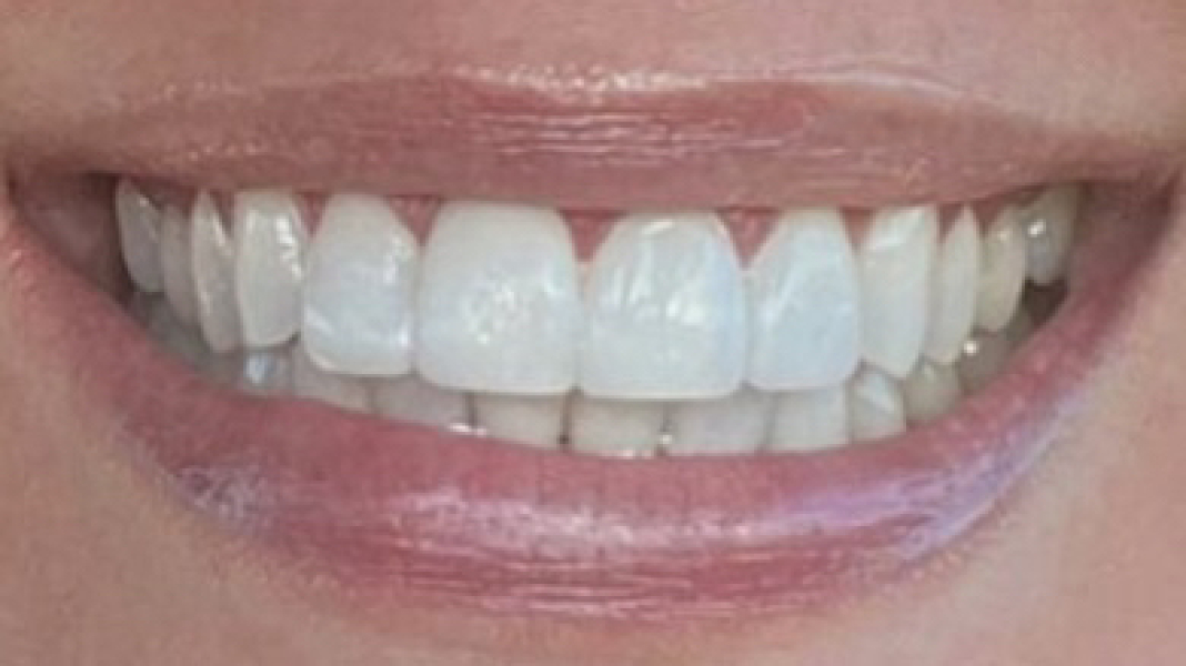 To spend £4k on my teeth? 