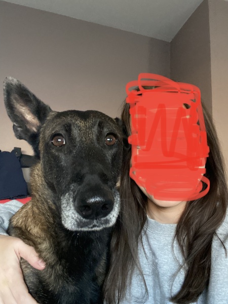 Can we muzzle all dogs in public yet (warning, graphic image of mauled hand)