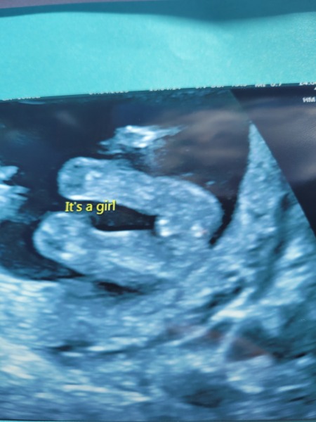 Did they tell us the wrong gender?