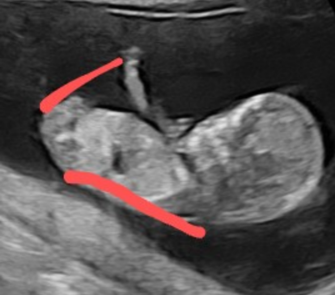 October - into the second trimester!