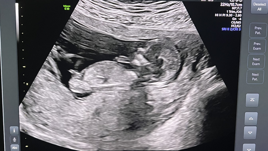 October - into the second trimester!