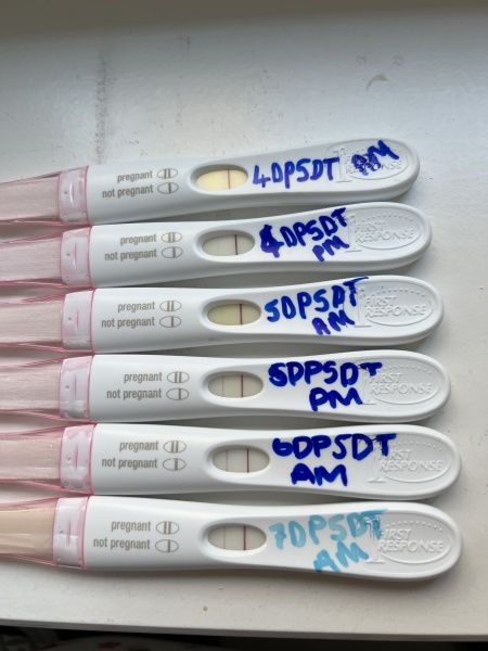 Poor line progression