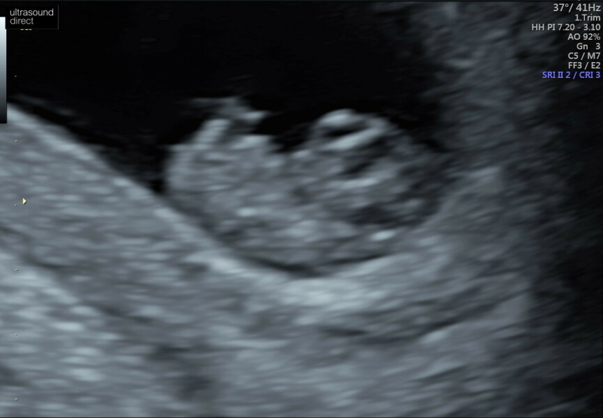 Due November 2023 Part 3