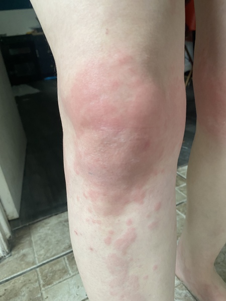 Do I need a second opinion on this? Medication related