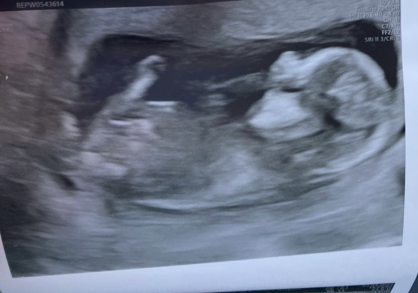 October - into the second trimester!