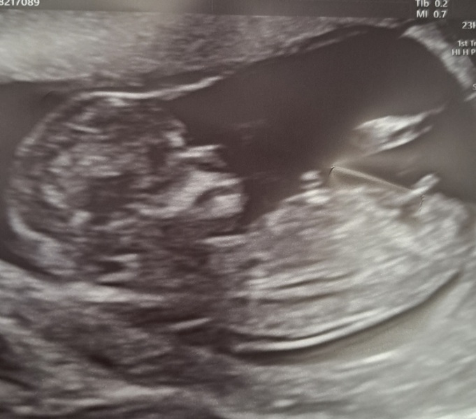 Nub theory guesses? 👶🏼♥️