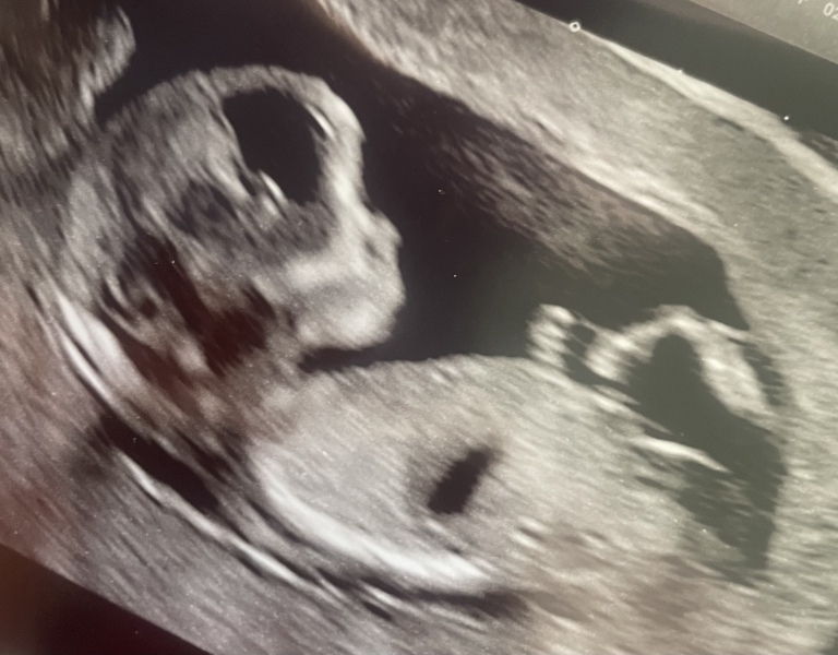 October - into the second trimester!