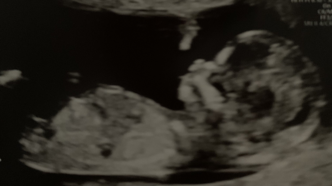 Is it a boy or girl?