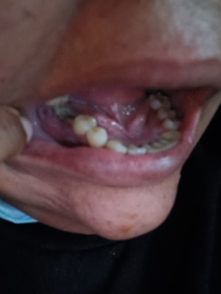 Any dentists around? Photo TMI !