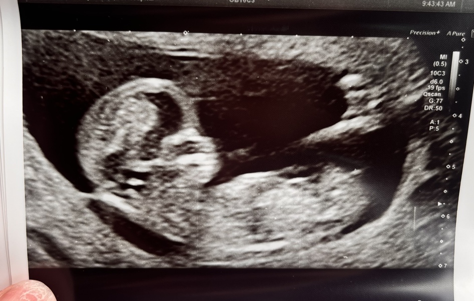 October - into the second trimester!