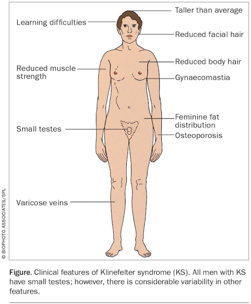 Would you ever consider a transman a man?