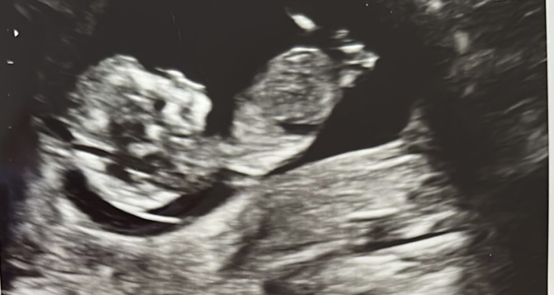 October - into the second trimester!