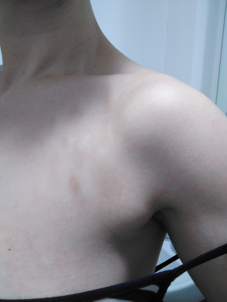 Patches on my chest 