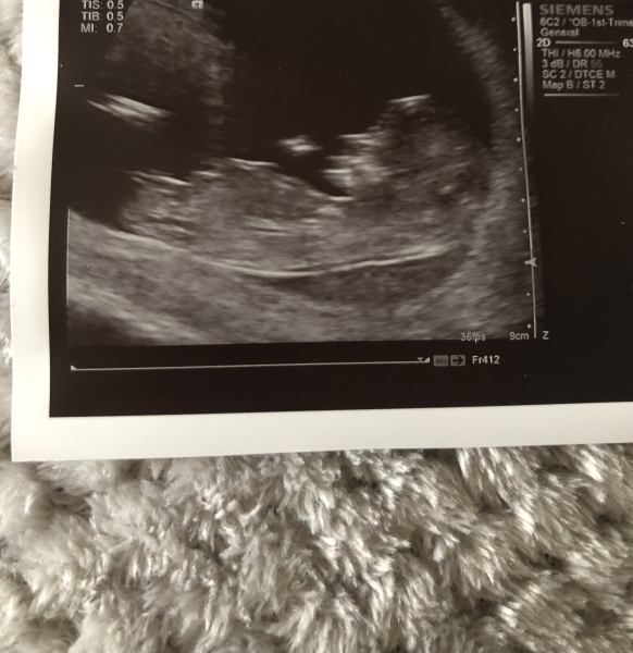 Due November 2023 Part 3