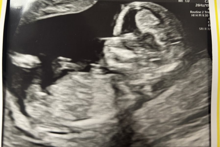 October - into the second trimester!