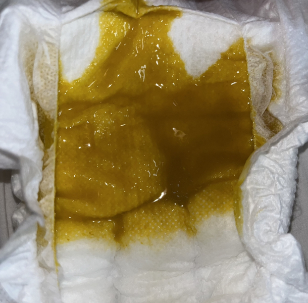 Overwhelmed trying to figure out what's wrong with my baby