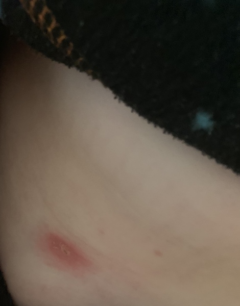 Can anyone shed light on children spots 