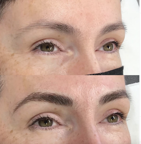 I'm getting my eyebrows microbladed this week 