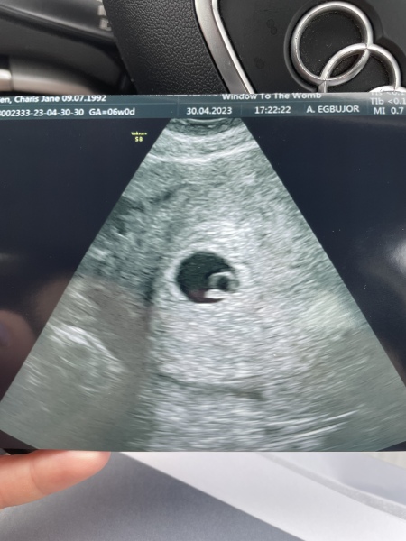 Due December 2023 part 2