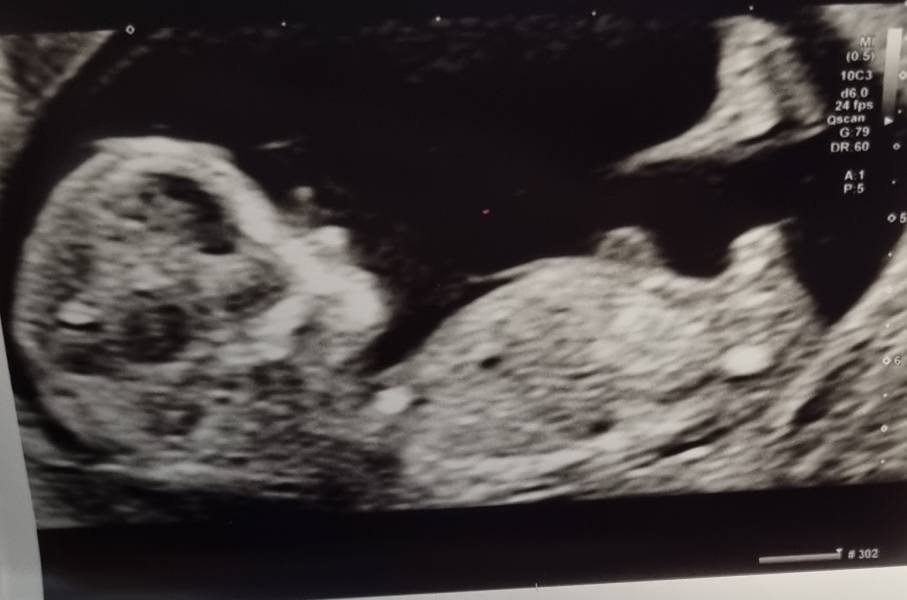 October - into the second trimester!