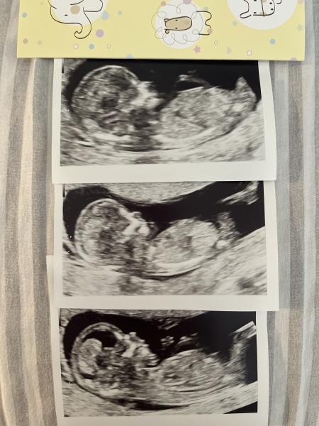 Nub theory guesses? 👶🏼♥️