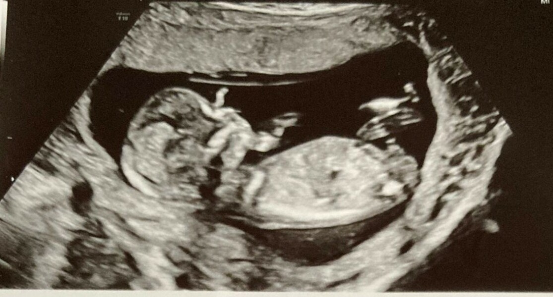 October - into the second trimester!
