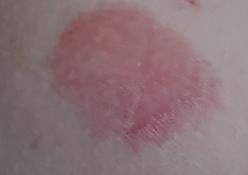 What is this thing on my leg?