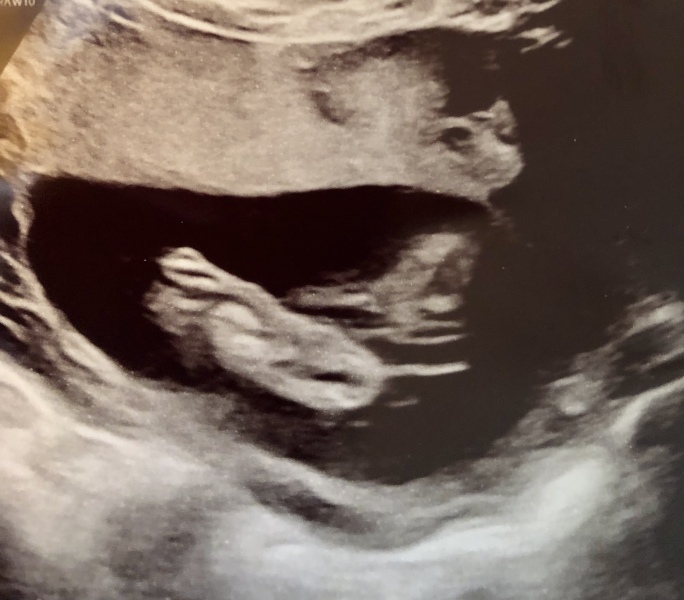 End Aug/Early Sept Due Date (Thread 2)