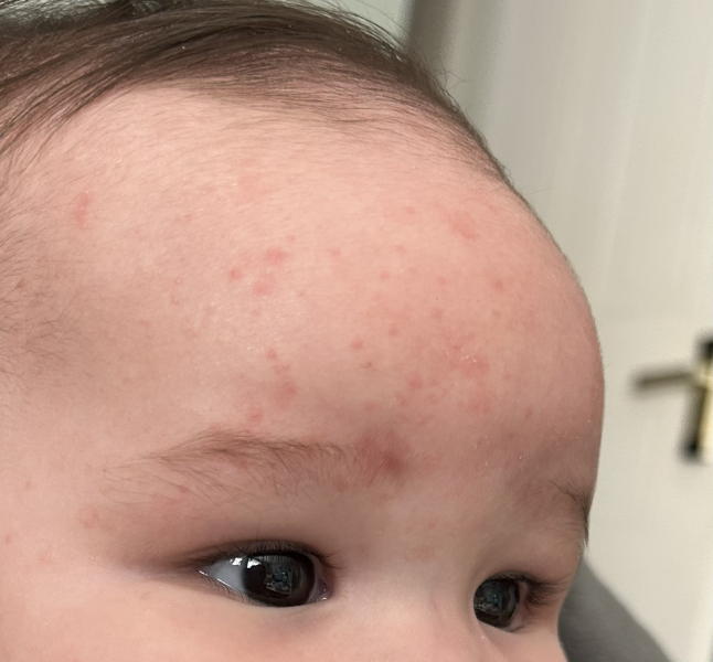 Rash. Advice please?